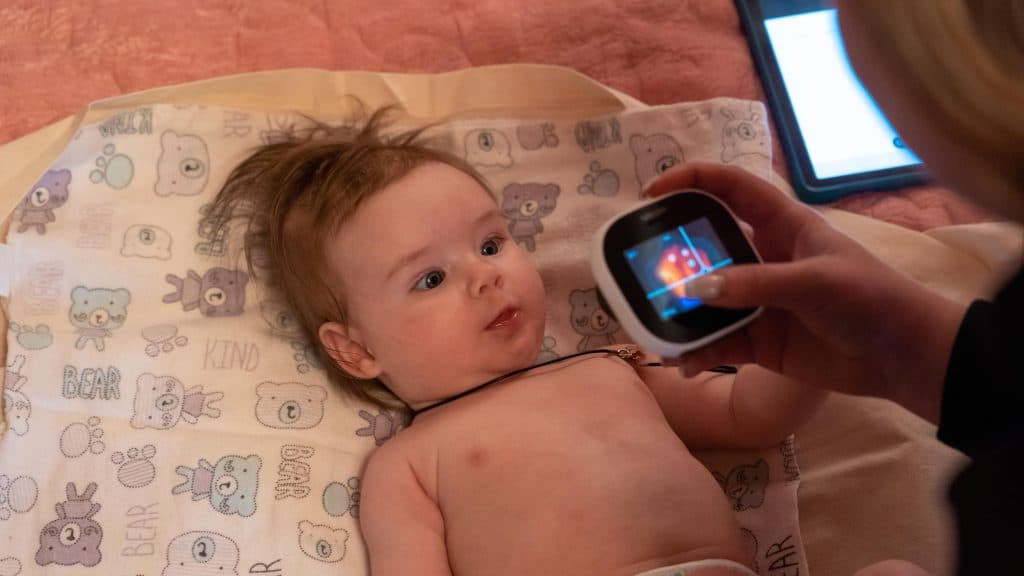 En Ukraine, Solomiia, 4 mois, bénéficie d'une visite médicale à domicile grâce au soutien de l'UNICEF© UNICEF/UNI519595/Vashkiv