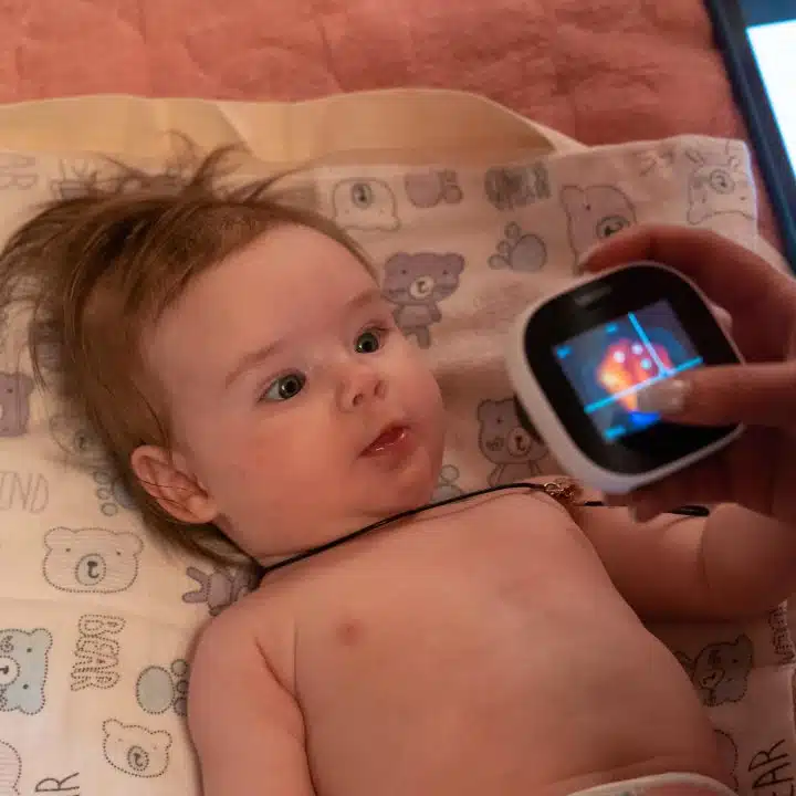 En Ukraine, Solomiia, 4 mois, bénéficie d'une visite médicale à domicile grâce au soutien de l'UNICEF© UNICEF/UNI519595/Vashkiv