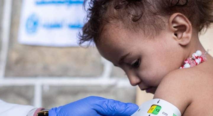 Un enfant fait l'objet d'un dépistage de l'émaciation sévère à l'aide d'un ruban de circonférence de la partie médiane du bras, dans une clinique mobile soutenue par l'UNICEF dans le district de Mazhar, dans le gouvernorat de Raymah, au Yémen. ⒸUNICEF Yemen/2022/Al-Haj