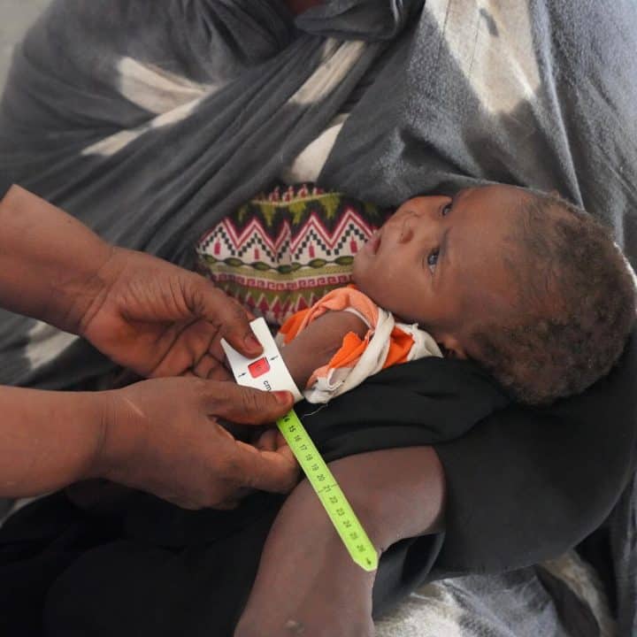 Alors que la guerre fait rage au Soudan, des millions d'enfants sont déplacés et les services de santé sont interrompus. Les taux de malnutrition aiguë sévère chez les enfants de moins de cinq ans explosent avec plus de 700 000 enfants souffrant de malnutrition aiguë sévère.© UNICEF/UNI409665/Awad