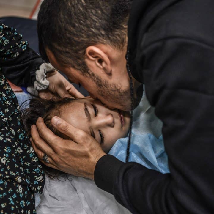 Ghazal, 4 ans, a perdu sa jambe à la suite du bombardement de sa maison dans la bande de Gaza© UNICEF/UNI488720/Zaqout