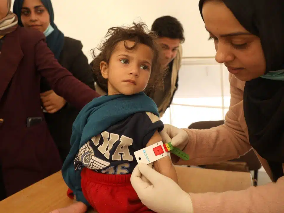 Leen, 2 ans, souffre de malnutrition aiguë sévère. Elle souffre d'une perte de poids et d'une atrophie musculaire drastiques. © UNICEF/UNI519940/El Baba