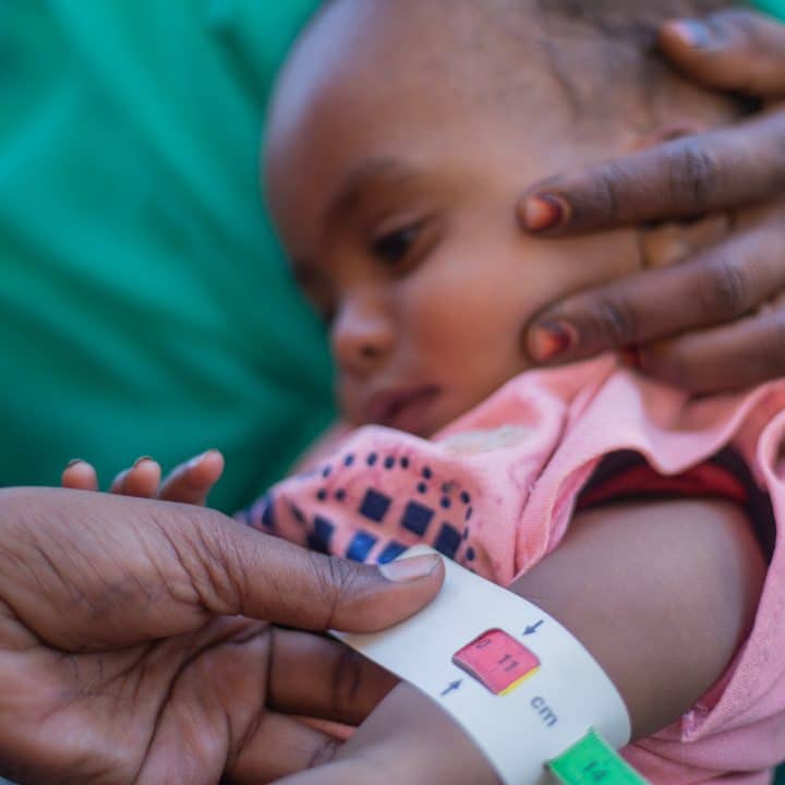 Au Soudan, Aida, 2 ans souffre de malnutrition et a besoin d'une prise en charge immédiate. Sa mère l'a donc emmenée dans un centre de santé soutenu par l'UNICEF © UNICEF/UNI529948/Mohamdeen