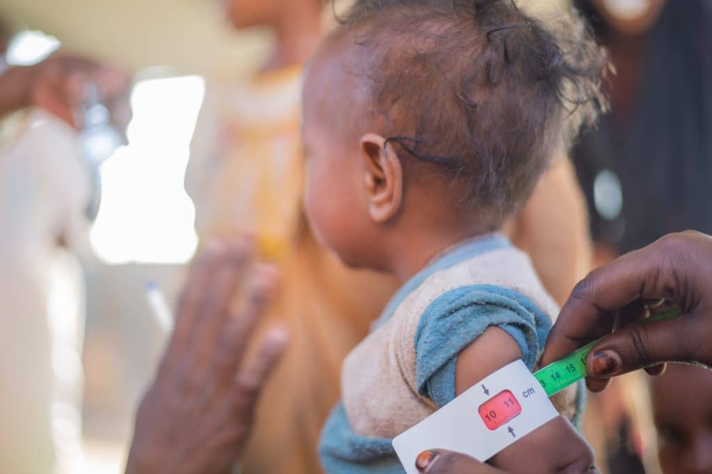 Alors que la guerre fait rage, des millions d'enfants sont déplacés et les services de santé sont interrompus. Les taux de malnutrition aiguë sévère chez les enfants de moins de cinq ans explosent avec plus de 700 000 enfants souffrant de malnutrition aiguë sévère.© UNICEF/UNI529922/Elfatih