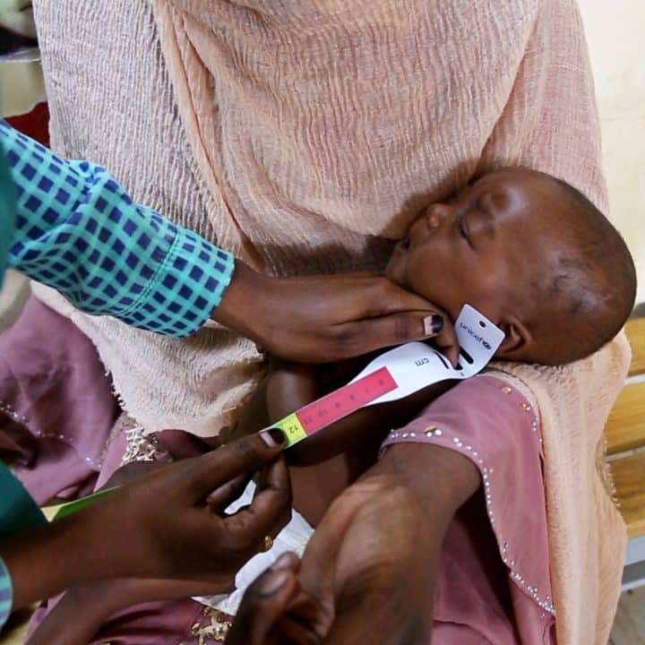 Un agent de santé de l'hôpital pour enfants de Damazine, dans l'État du Nil Bleu, contrôle l'état nutritionnel de Baraa, âgée de 6 mois, lors d'une visite à l'hôpital. Baraa souffre de malnutrition aiguë sévère et est inscrite à un programme de nutrition soutenu par l'UNICEF pour des soins et un traitement. © UNICEF/UNI593591